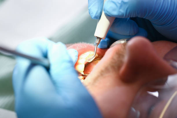Best Emergency Treatment for Toothache in Manchester, KY