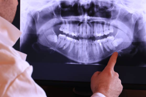 Best Emergency Root Canal Treatment in Manchester, KY